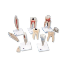 Lidské zuby sada 5 modelů