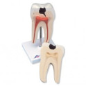 Zub stolička s kazem - model 2-díly